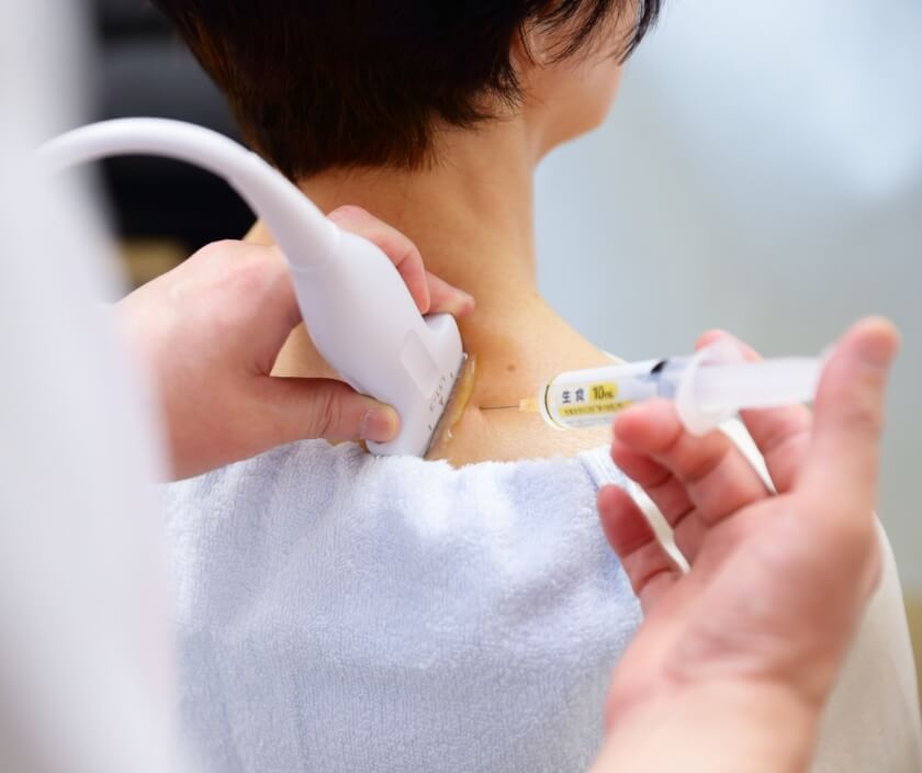 事故・むちうちは初期治療が大切！